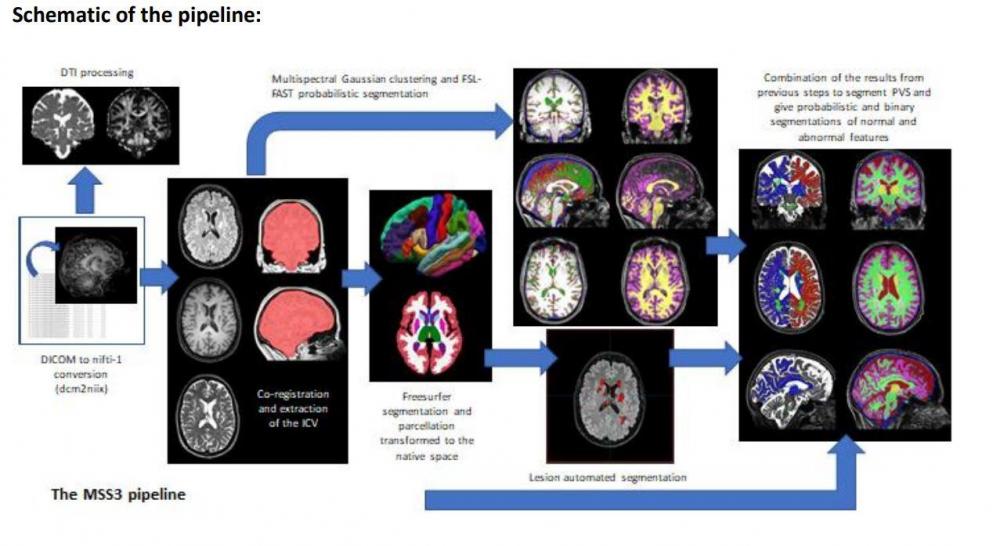 Schematic of brain imaging pipeline
